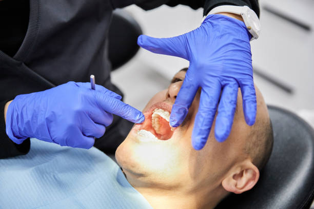Best Emergency Dentist for Knocked-Out Tooth in Dundee, MI