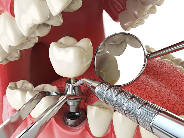 Best Emergency Dentist for Special Needs Patients in Dundee, MI
